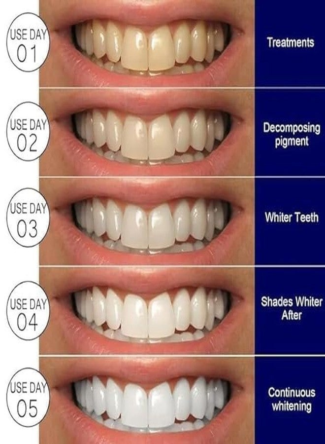 GHARKART شرائط تبييض الأسنان من غاركارت، شرائط تبييض أسنان محمولة، شرائط بيضاء تقلل من حساسية الأسنان، مبيض لإزالة بقع التدخين والقهوة، طقم تبييض أسنان فعال للاستخدام المنزلي (14 قطعة = 7 أزواج) - Image 3